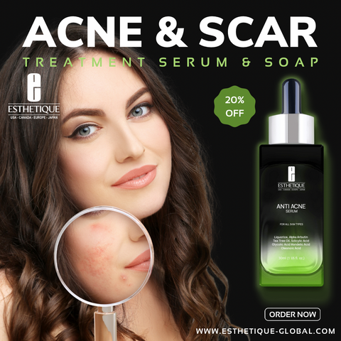 Anti Acne Serum